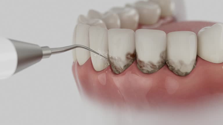 Trusted Teeth Cleaning And Checkup service in Parchment, MI - Dentist Open Now